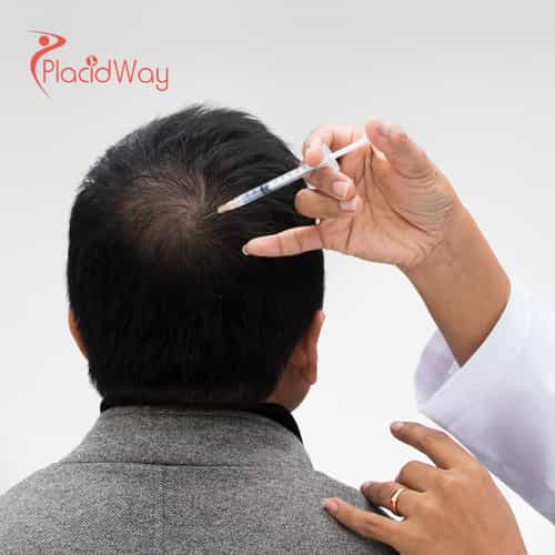 Stem Cell Hair Regrowth in Japan: The Ultimate Guide to Regenerative Hair Restoration